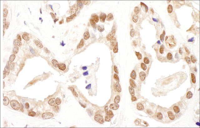 Rabbit anti-FANCD2 Antibody, Affinity Purified