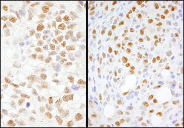 Rabbit anti-NONO Antibody, Affinity Purified