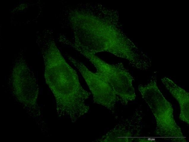 Monoclonal Anti-TRAPPC4 antibody produced in mouse