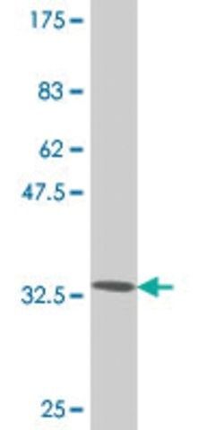 Monoclonal Anti-TWIST1 antibody produced in mouse