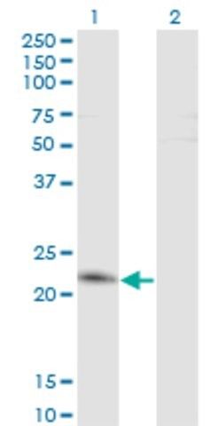 Monoclonal Anti-TWIST2 antibody produced in mouse