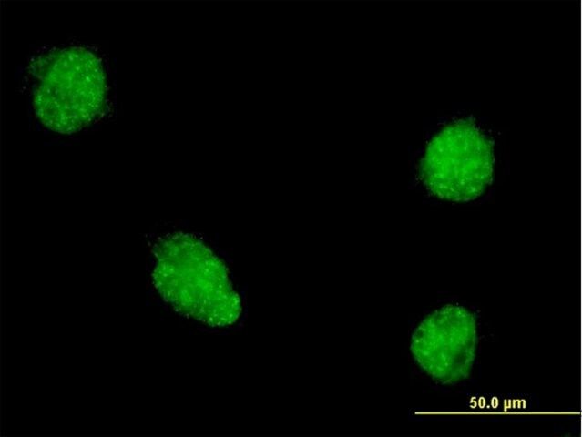 Monoclonal Anti-TWIST1 antibody produced in mouse