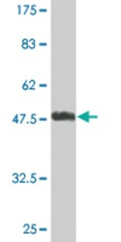 Monoclonal Anti-UBE2T antibody produced in mouse