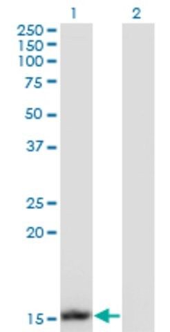 Monoclonal Anti-UBE2B antibody produced in mouse