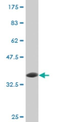 Monoclonal Anti-UBE3A antibody produced in mouse