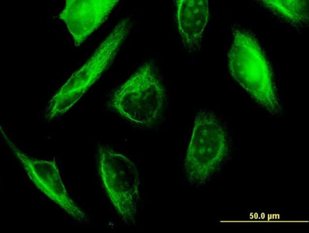 Monoclonal Anti-TUBA3, (C-terminal) antibody produced in mouse