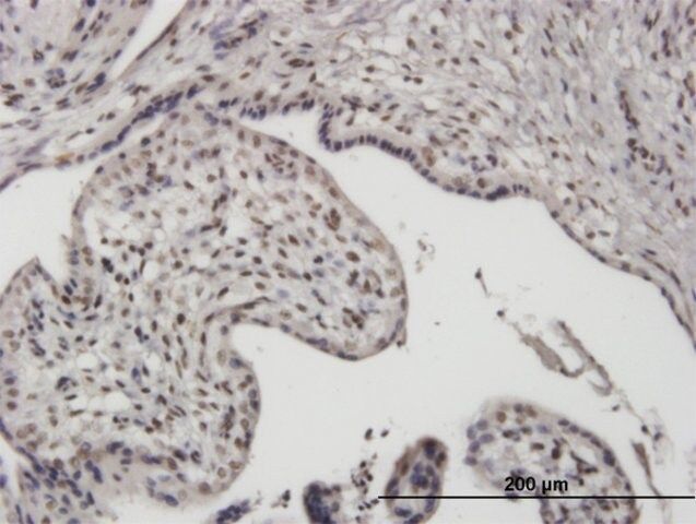 Monoclonal Anti-UBTF antibody produced in mouse