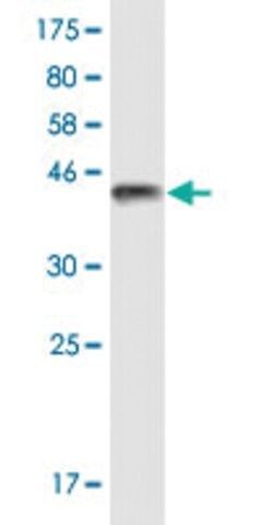 Monoclonal Anti-TRPV1 antibody produced in mouse