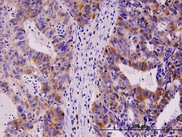 Monoclonal Anti-TYMS antibody produced in mouse