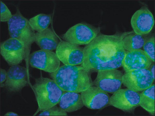 Monoclonal Anti-TUBB3 antibody produced in mouse