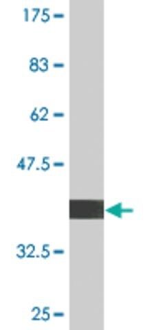 Monoclonal Anti-UBE4B, (C-terminal) antibody produced in mouse