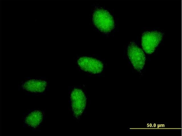 Monoclonal Anti-UBE2C antibody produced in mouse