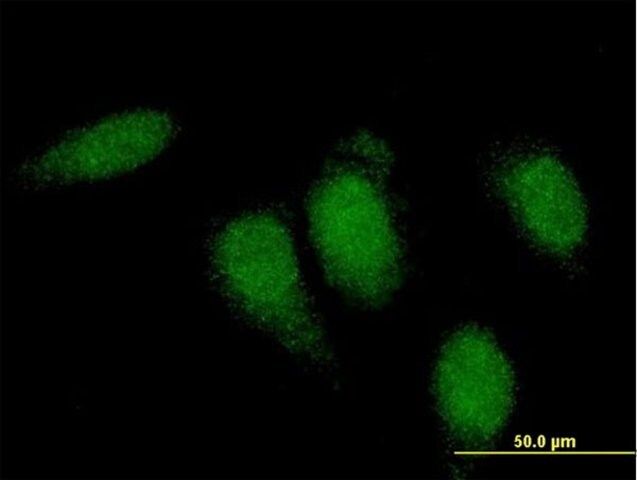 Monoclonal Anti-TTN, (N-terminal) antibody produced in mouse