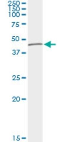 Monoclonal Anti-TUBD1 antibody produced in mouse