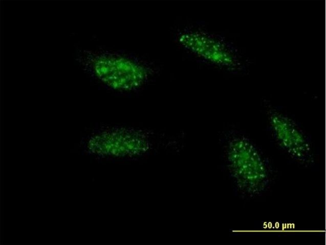 Monoclonal Anti-TWIST1, (C-terminal) antibody produced in mouse