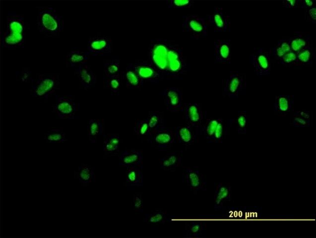 Monoclonal Anti-UBTF antibody produced in mouse