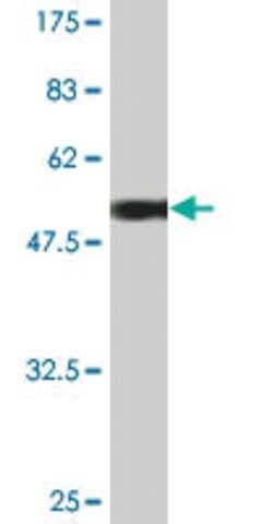 Monoclonal Anti-UCHL1 antibody produced in mouse