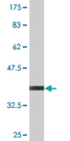 Monoclonal Anti-UBE2B antibody produced in mouse