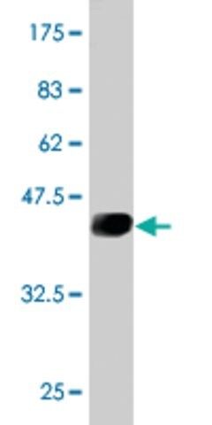 Monoclonal Anti-UBE2D3 antibody produced in mouse