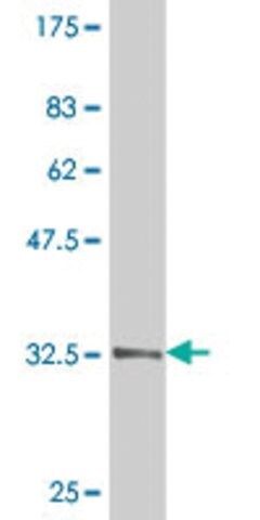 Monoclonal Anti-TWIST1 antibody produced in mouse