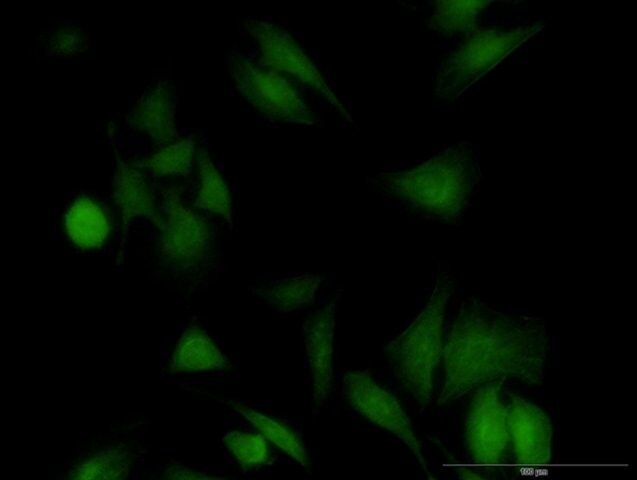 Monoclonal Anti-UBE2G1 antibody produced in mouse