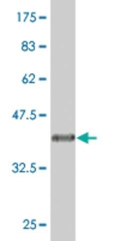 Monoclonal Anti-UBTF antibody produced in mouse