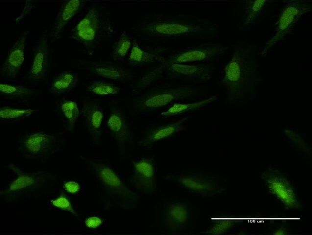 Monoclonal Anti-UBR1 antibody produced in mouse