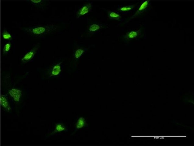 Monoclonal Anti-UBE2E3 antibody produced in mouse