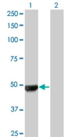 Monoclonal Anti-UBR2, (N-terminal) antibody produced in mouse