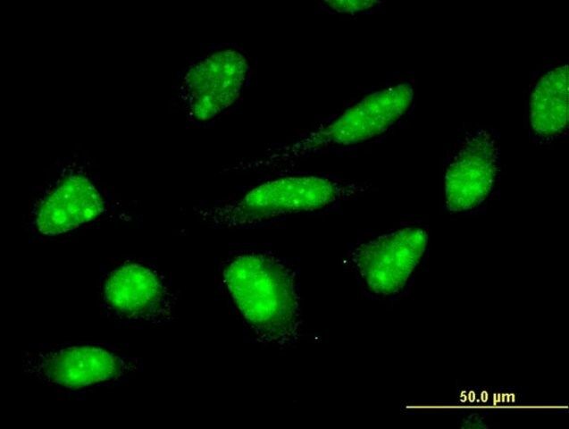 Monoclonal Anti-ZNF396 antibody produced in mouse