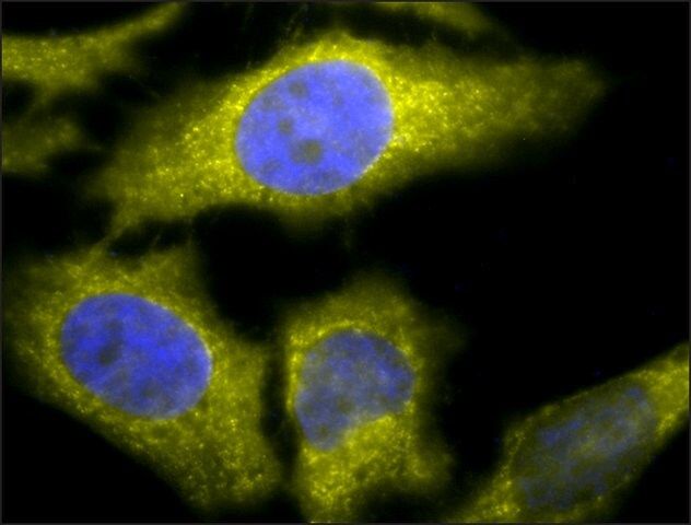 Monoclonal Anti-Tcp1 Alpha-Apc antibody produced in rat