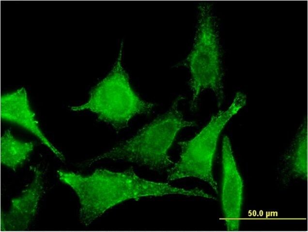 Monoclonal Anti-TBCC antibody produced in mouse