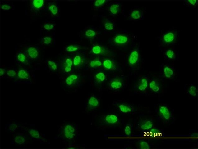 Monoclonal Anti-TCF7L2 antibody produced in mouse