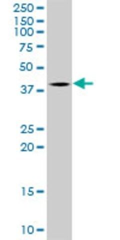 Monoclonal Anti-TFB2M, (C-terminal) antibody produced in mouse