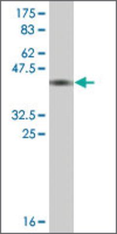 Monoclonal Anti-THOP1 antibody produced in mouse