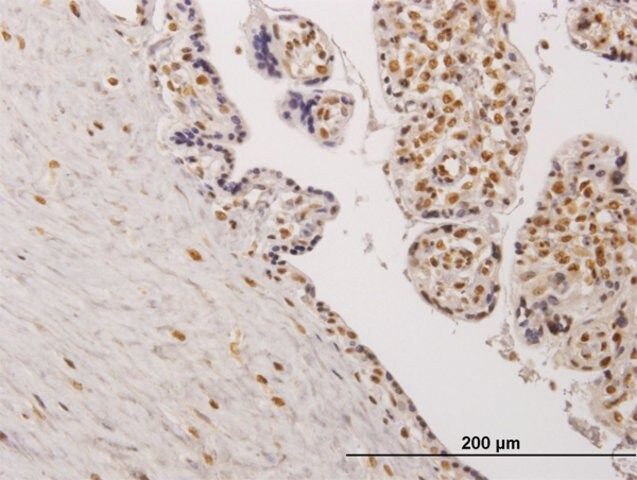Monoclonal Anti-TESK2, (C-terminal) antibody produced in mouse