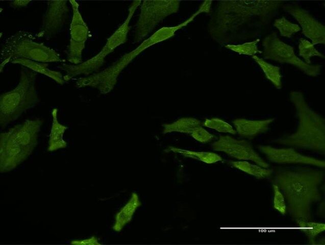 Monoclonal Anti-TNFRSF21 antibody produced in mouse