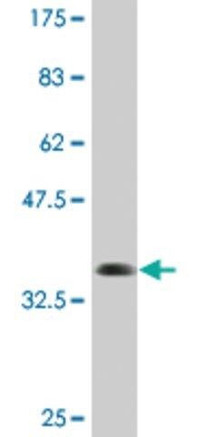 Monoclonal Anti-TNRC6B antibody produced in mouse