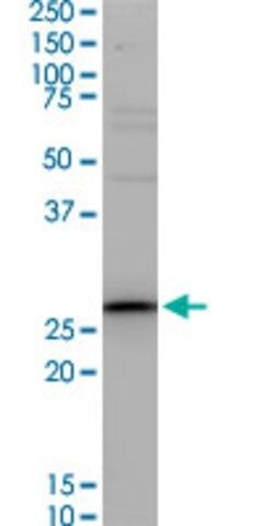 Monoclonal Anti-TNNT3, (C-terminal) antibody produced in mouse