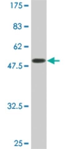 Monoclonal Anti-SERPINC1 antibody produced in mouse