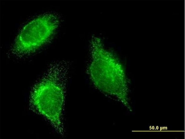 Monoclonal Anti-SFTPD antibody produced in mouse