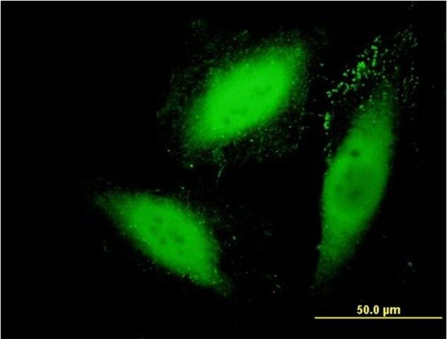 Monoclonal Anti-SGK2 antibody produced in mouse