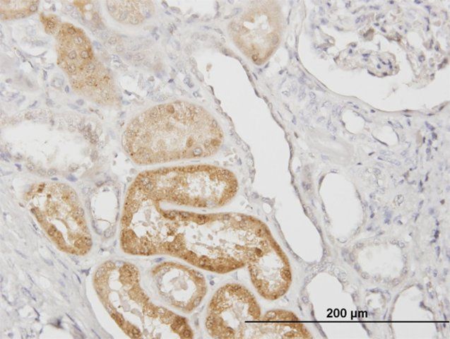 Monoclonal Anti-SERPINA3, (C-terminal) antibody produced in mouse