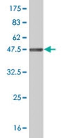 Monoclonal Anti-NDUFB11 antibody produced in mouse