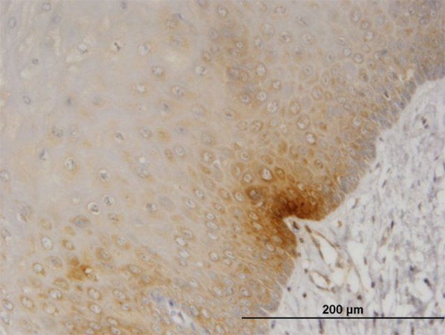 Monoclonal Anti-DYRK2, (N-terminal) antibody produced in mouse