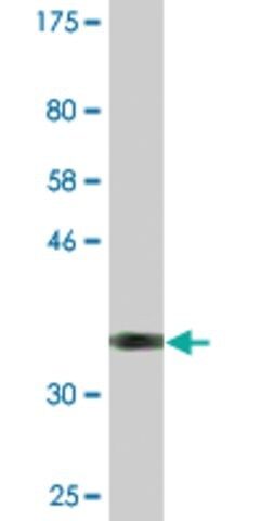 Monoclonal Anti-DUX3, (N-terminal) antibody produced in mouse