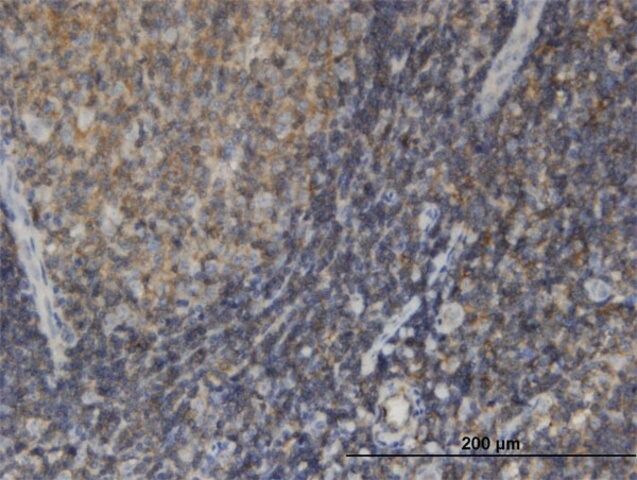 Monoclonal Anti-EDC4, (C-terminal) antibody produced in mouse