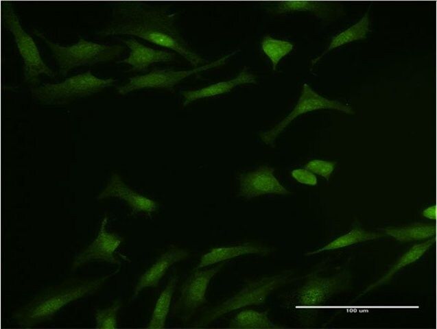Monoclonal Anti-DYNLL1, (N-terminal) antibody produced in mouse