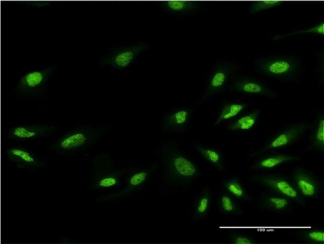 Monoclonal Anti-EHMT1, (N-terminal) antibody produced in mouse