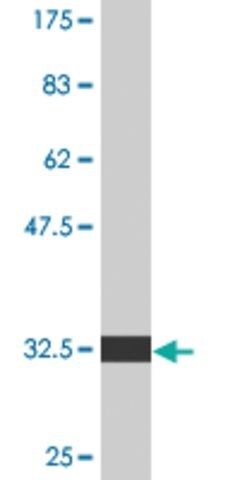 Monoclonal Anti-EDNRA antibody produced in mouse